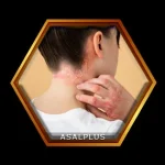 تسکین عفونت های پوستی مقاوم با عسل طبیعی عسل پلاس asalplus.com relief of mrsa skin infections with honey