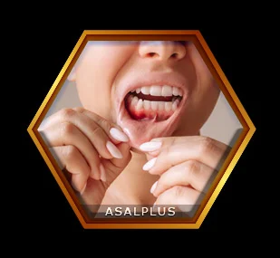 درمان التهاب لثه و سلامت لثه با عسل طبیعی عسل پلاس asalplus.com treatment of gingivitis and gum inflammation with honey