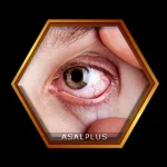 درمان عفونت چشمی با عسل طبیعی عسل پلاس asalplus.com eye infection treatment with honey