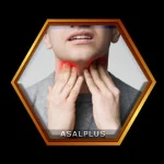 درمان پرکاری تیروئید با عسل طبیعی عسل پلاس asalplus.com hyperthyroidism management with honey