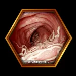 مهار باکتری‌های مضر گوارشی عسل پلاس asalplus.com harmful gut bacteria control with honey